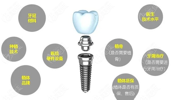 种植牙技术革新与市场发展动态最新消息